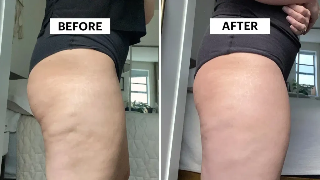 Do Toning Exercise Sudbury Really Tackle Cellulite?