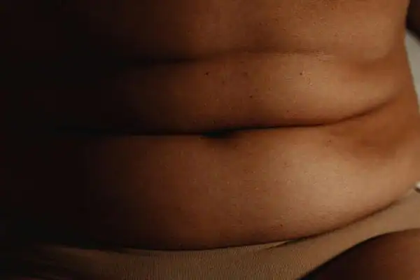 The Hidden Connection: How Stress Shapes Your Fitness and Body Composition 3 image of what stress can do on the stomach area and how Lipo 360 Sudbury can help to change your body shape.