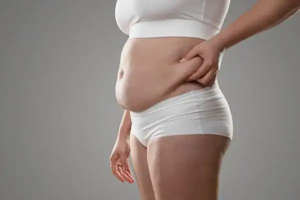 Image of stress belly Sudbury How Lipo 360 can help manage your symptoms