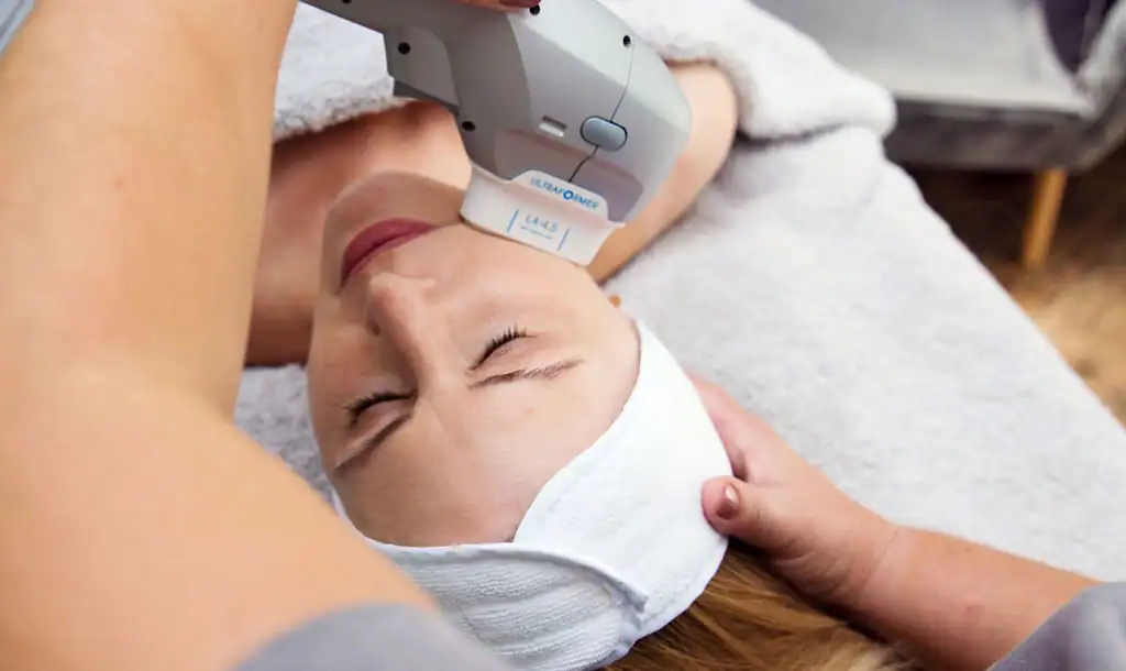 Discover the Perfect Duo: Morpheus8 and HIFU 1 Image of Morpheus8 And HIFU Sudbury combined treatment